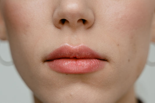cupids bow